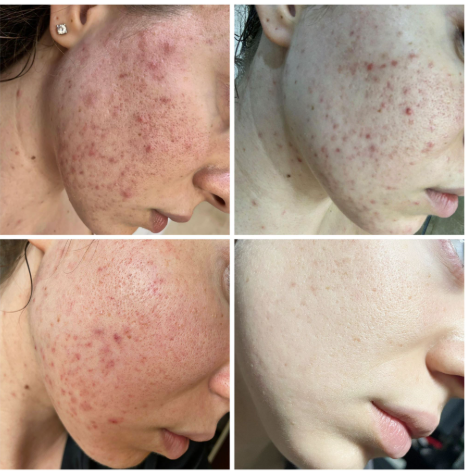 LoveLife Skin+ by med. Marci 250ml - obrazek 3