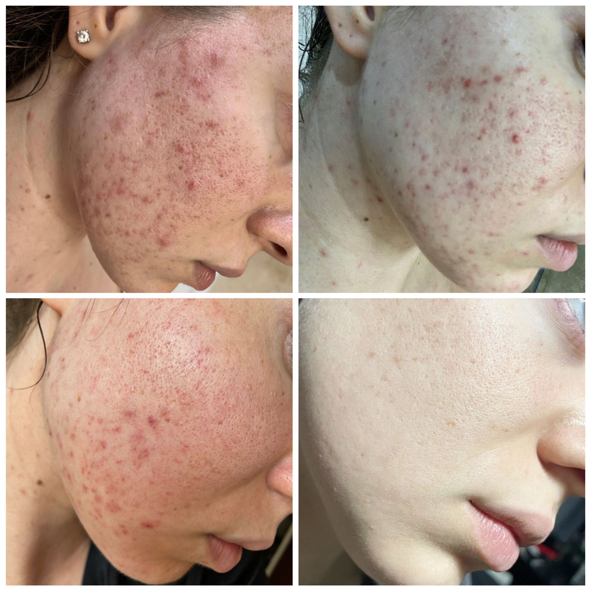 Zestaw Lovelife Omega-3 DHA + Skin by med. Marci 2x250ml - obrazek 4