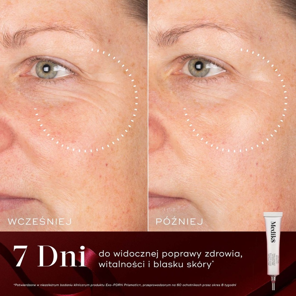 Medik8 Rejuvenation Routine – zestaw świąteczny Crystal Retinal 3 30 ml + Daily Radiance Vitamin C SPF 30 50 ml + Exo-PDRN Prismatic+ 4 ml - obrazek 5